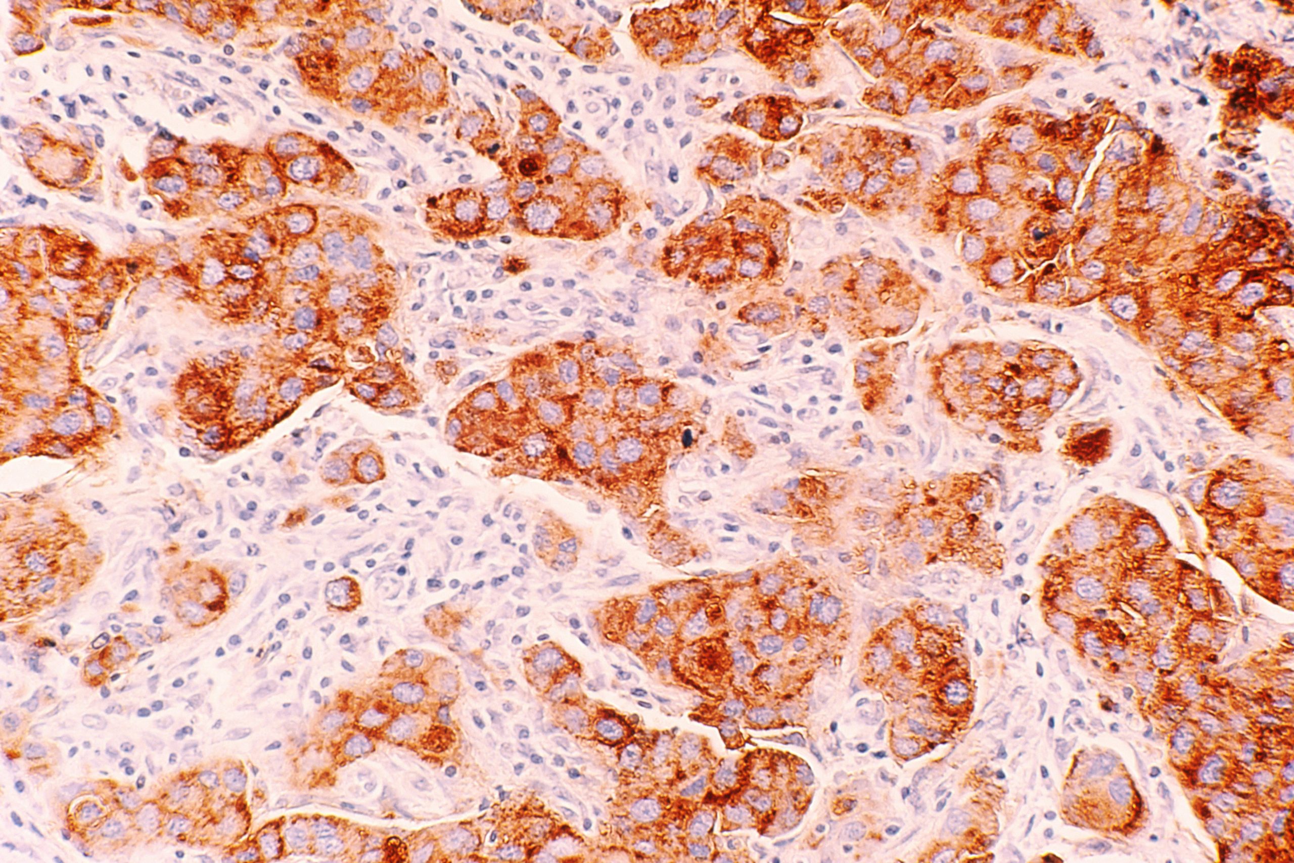What is cancer?