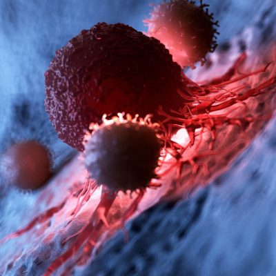 The changes driving Cancer Progression