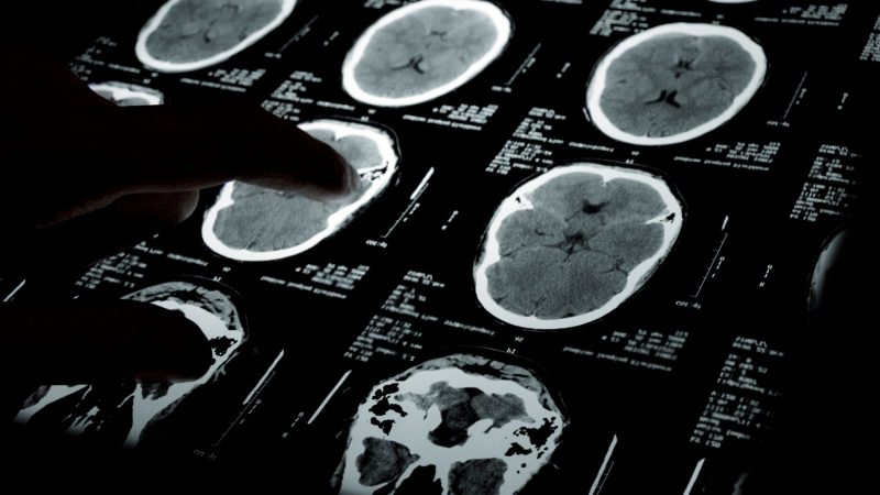 The tumor microenvironment and integrated cellular medicine: the new frontier in precision oncology
